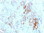 Ferritin, Light Chain (Node-Negative Breast Tumor Prognostic Marker) Antibody in Immunohistochemistry (Paraffin) (IHC (P))