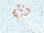 Ferritin, Light Chain (Node-Negative Breast Tumor Prognostic Marker) Antibody in Immunohistochemistry (Paraffin) (IHC (P))