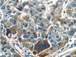 TPTE2 Antibody in Immunohistochemistry (Paraffin) (IHC (P))