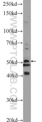 TPTE2 Antibody in Western Blot (WB)