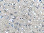 HAP1 Antibody in Immunohistochemistry (Paraffin) (IHC (P))