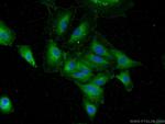 DAPK1 Antibody in Immunocytochemistry (ICC/IF)