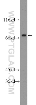 ZNF326 Antibody in Western Blot (WB)