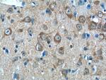 LIN7A Antibody in Immunohistochemistry (Paraffin) (IHC (P))