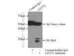 LIN7A Antibody in Immunoprecipitation (IP)