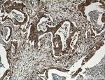 ATG2B Antibody in Immunohistochemistry (Paraffin) (IHC (P))