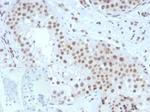 Steroidogenic Factor 1 (SF-1) (Transcription Factor) Antibody in Immunohistochemistry (Paraffin) (IHC (P))