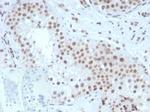 Steroidogenic Factor 1 (SF-1) (Transcription Factor) Antibody in Immunohistochemistry (Paraffin) (IHC (P))