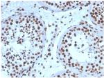 Steroidogenic Factor 1 (SF-1) Antibody in Immunohistochemistry (Paraffin) (IHC (P))