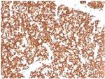 Steroidogenic Factor 1 (SF-1) Antibody in Immunohistochemistry (Paraffin) (IHC (P))