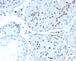 Steroidogenic Factor 1 (SF-1) Antibody in Immunohistochemistry (Paraffin) (IHC (P))