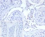 Steroidogenic Factor 1 (SF-1) Antibody in Immunohistochemistry (Paraffin) (IHC (P))