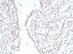 Steroidogenic Factor 1 (SF-1) Antibody in Immunohistochemistry (Paraffin) (IHC (P))