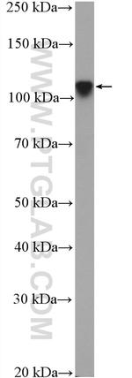 ZNF711 Antibody in Western Blot (WB)