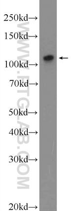 ZNF711 Antibody in Western Blot (WB)