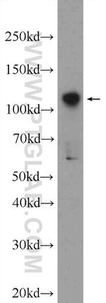 ZNF711 Antibody in Western Blot (WB)