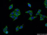 ALDH1A3 Antibody in Immunocytochemistry (ICC/IF)