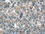 ALDH1A3 Antibody in Immunohistochemistry (Paraffin) (IHC (P))