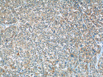 ALDH1A3 Antibody in Immunohistochemistry (Paraffin) (IHC (P))