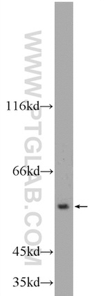 ALDH1A3 Antibody in Western Blot (WB)