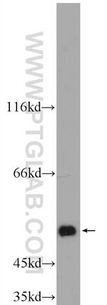 ALDH1A3 Antibody in Western Blot (WB)