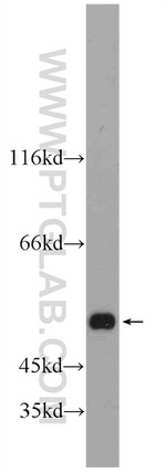 ALDH1A3 Antibody in Western Blot (WB)