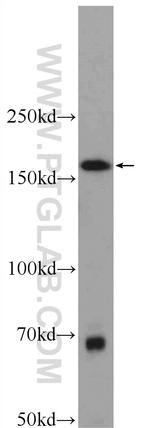 SAMD9L Antibody in Western Blot (WB)