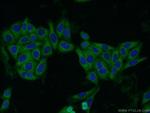 QPRT Antibody in Immunocytochemistry (ICC/IF)