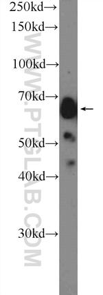 Glypican 3 Antibody in Western Blot (WB)