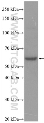 HYAL1 Antibody in Western Blot (WB)