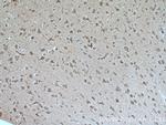 ROBO1 Antibody in Immunohistochemistry (Paraffin) (IHC (P))