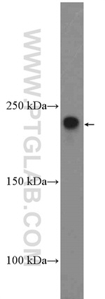 ROBO1 Antibody in Western Blot (WB)