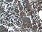 GBF1 Antibody in Immunohistochemistry (Paraffin) (IHC (P))