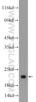 RSL24D1 Antibody in Western Blot (WB)