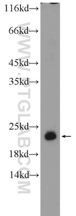 RSL24D1 Antibody in Western Blot (WB)