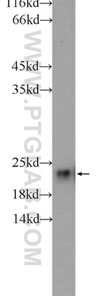 RSL24D1 Antibody in Western Blot (WB)