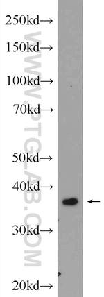 FBP2 Antibody in Western Blot (WB)