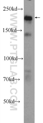 ZCCHC6 Antibody in Western Blot (WB)