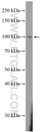 DAAM2 Antibody in Western Blot (WB)