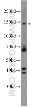 ZBTB11 Antibody in Western Blot (WB)