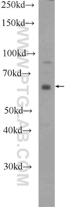 DACH2 Antibody in Western Blot (WB)