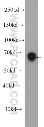 DACH2 Antibody in Western Blot (WB)