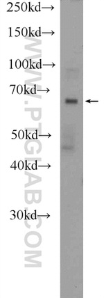 DACH2 Antibody in Western Blot (WB)