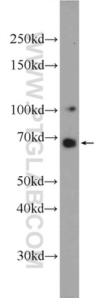 DACH2 Antibody in Western Blot (WB)