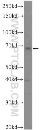 DTX4 Antibody in Western Blot (WB)