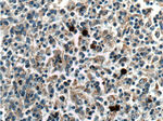 Galectin 10 Antibody in Immunohistochemistry (Paraffin) (IHC (P))