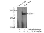 KIAA0430 Antibody in Immunoprecipitation (IP)