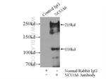 NCOA6 Antibody in Immunoprecipitation (IP)