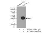 ASBT Antibody in Immunoprecipitation (IP)