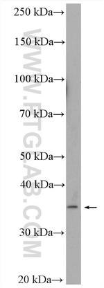 ASBT Antibody in Western Blot (WB)